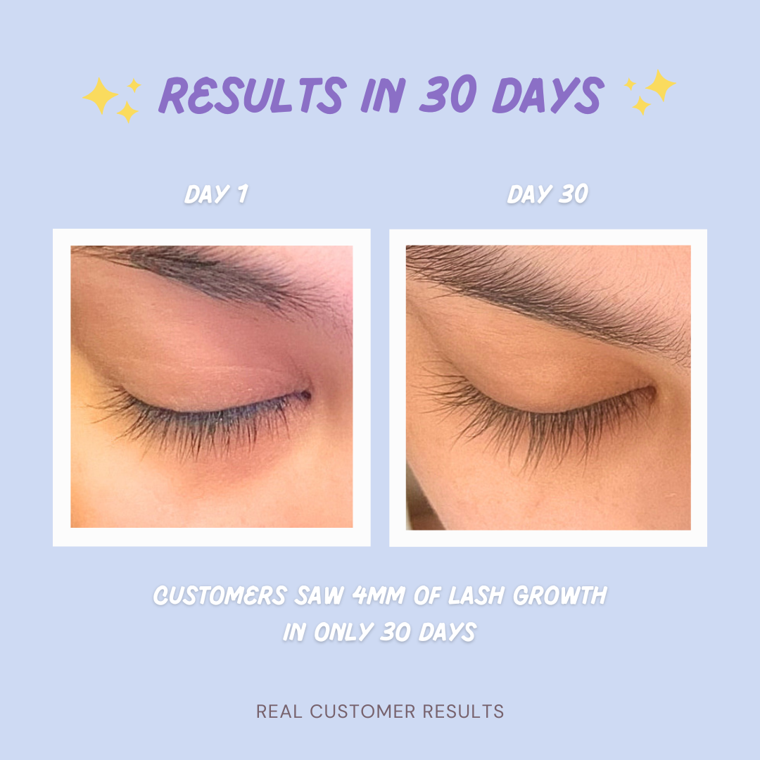 lash_serum_-_results_0ab50416-cdb1-4764-b17d-7c1d3d7ff9c0.png